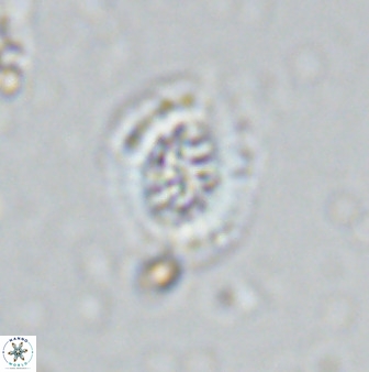 Retecapsa sinuosa 34526