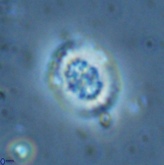 Retecapsa sinuosa 34529