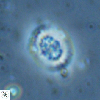 Retecapsa sinuosa 34529