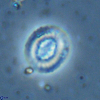 Retecapsa sinuosa 34531