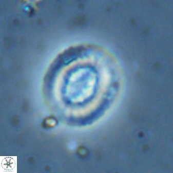 Retecapsa sinuosa 34531