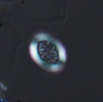 Retecapsa surirella 13129