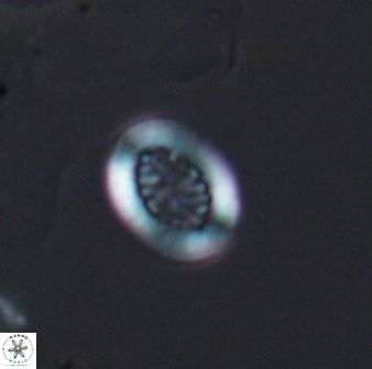 Retecapsa surirella 13129