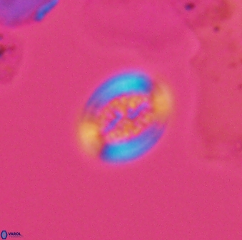 Retecapsa surirella 13134