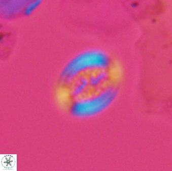 Retecapsa surirella 13134