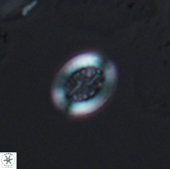 Retecapsa surirella 13135