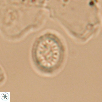 Retecapsa surirella 13136