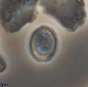 Retecapsa surirella 13137