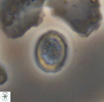 Retecapsa surirella 13137