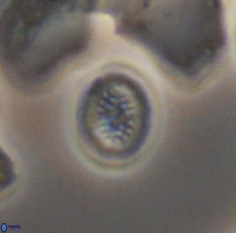 Retecapsa surirella 13138