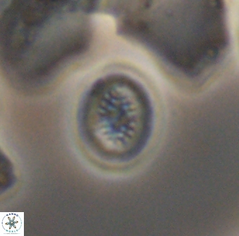 Retecapsa surirella 13138