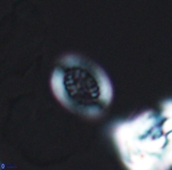 Retecapsa surirella 13139