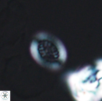 Retecapsa surirella 13139