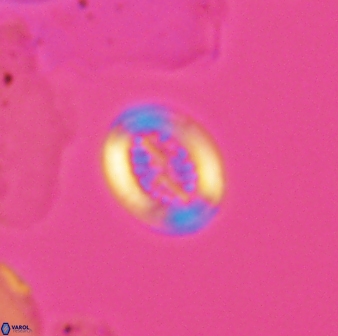 Retecapsa surirella 13130