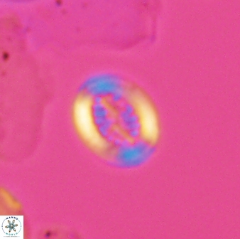 Retecapsa surirella 13130