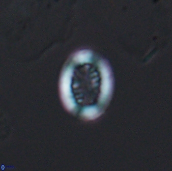 Retecapsa surirella 13131