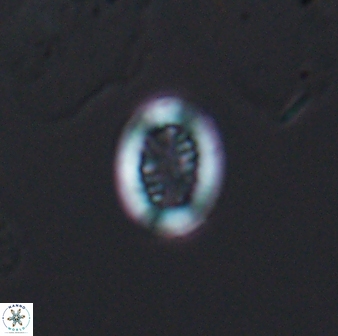 Retecapsa surirella 13131
