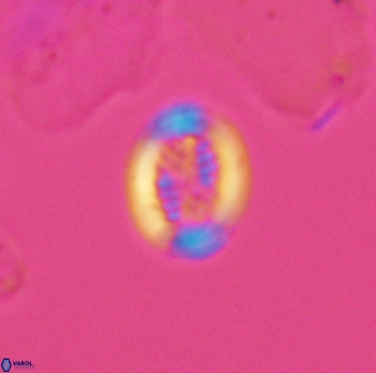 Retecapsa surirella 13132