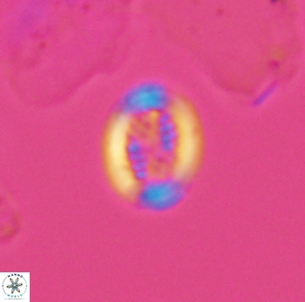 Retecapsa surirella 13132