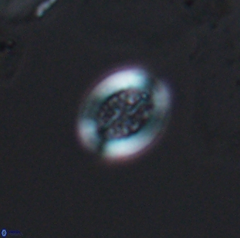 Retecapsa surirella 13133