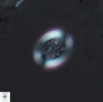 Retecapsa surirella 13133