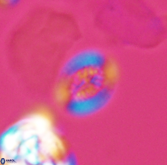 Retecapsa surirella 13144