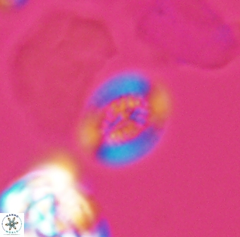 Retecapsa surirella 13144