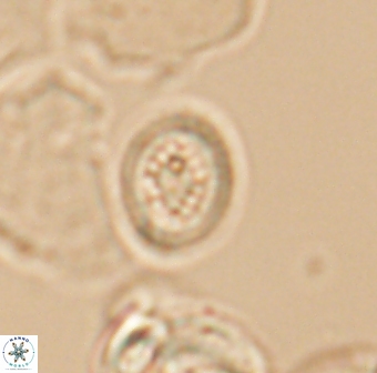 Retecapsa surirella 13145