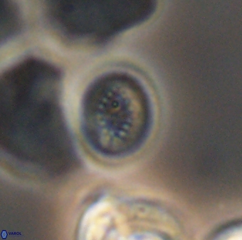 Retecapsa surirella 13146