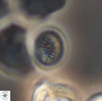 Retecapsa surirella 13146