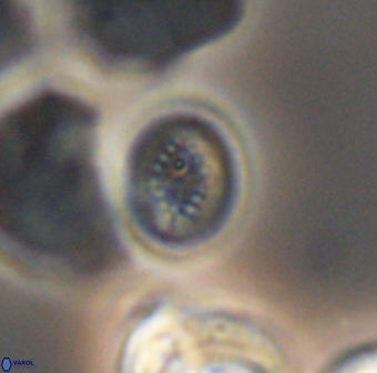 Retecapsa surirella 13147