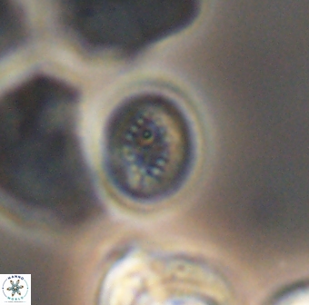 Retecapsa surirella 13147