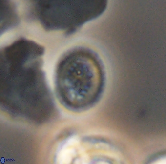 Retecapsa surirella 13148