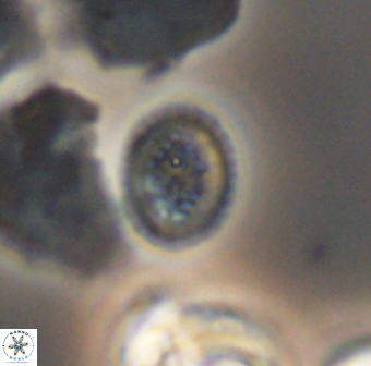 Retecapsa surirella 13148