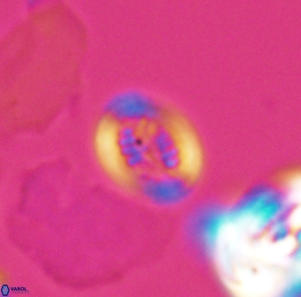 Retecapsa surirella 13140