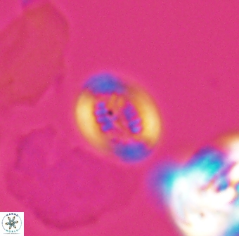Retecapsa surirella 13140