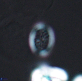 Retecapsa surirella 13141