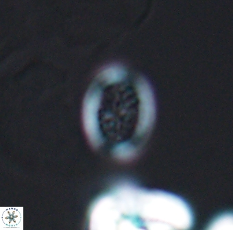 Retecapsa surirella 13141