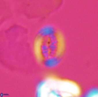 Retecapsa surirella 13142