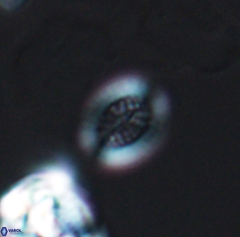 Retecapsa surirella 13143