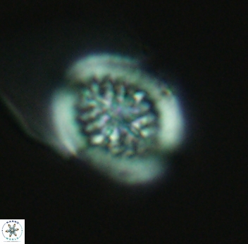 Retecapsa surirella 3948