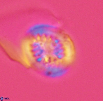 Retecapsa surirella 3949