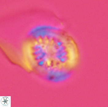 Retecapsa surirella 3949