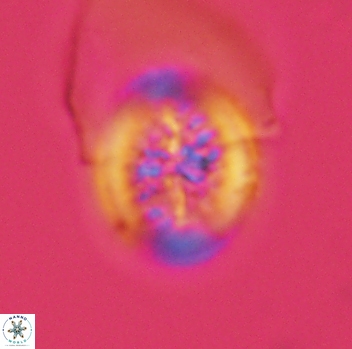 Retecapsa surirella 3950