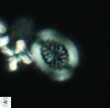 Retecapsa surirella 4237