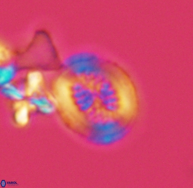 Retecapsa surirella 4238