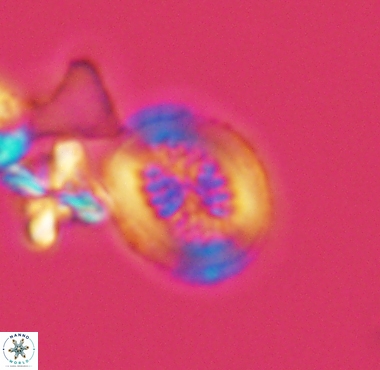 Retecapsa surirella 4238