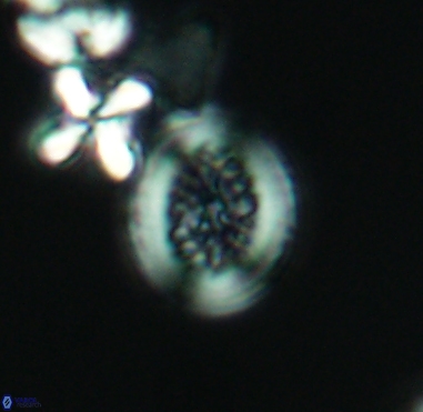 Retecapsa surirella 4239