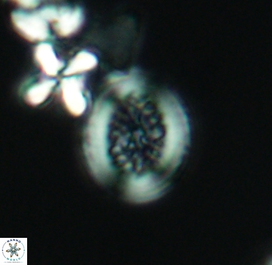 Retecapsa surirella 4239