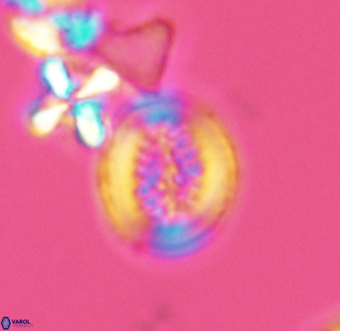 Retecapsa surirella 4240